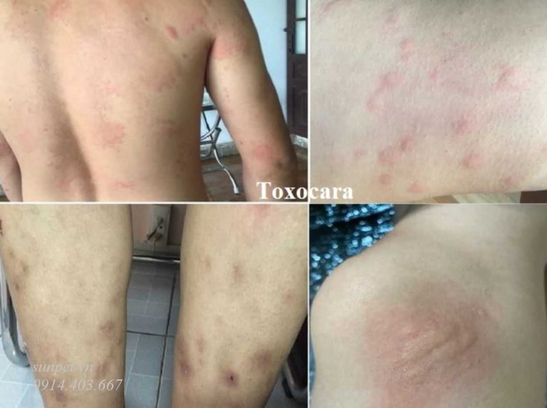 Trứng sán mèo và nguy cơ lây nhiễm cho người